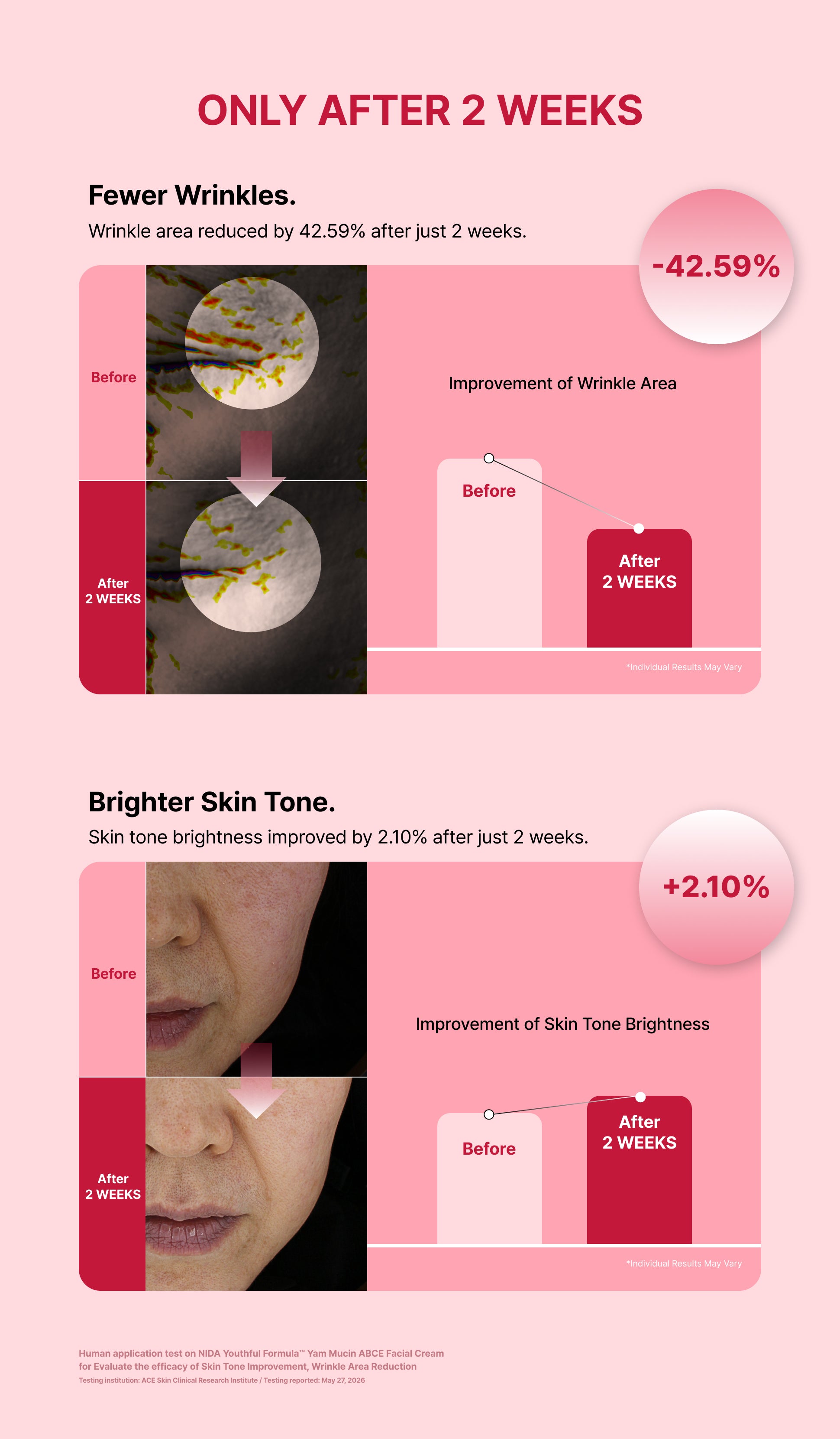 Skin analysis images of the wrinkle area before and after 2 weeks of use