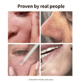 NIDA White Black Exfoliating Serum Duo Bundle